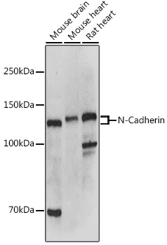 N-Cadherin Rabbit Polyclonal Antibody