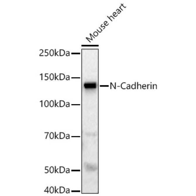 N-Cadherin Rabbit Polyclonal Antibody