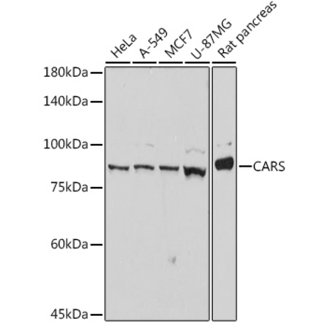 CARS Rabbit Monoclonal Antibody