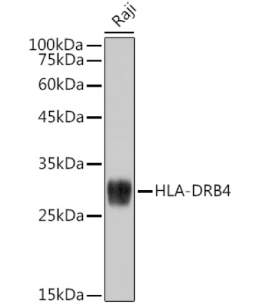 HLA-DRB4 Rabbit Monoclonal Antibody