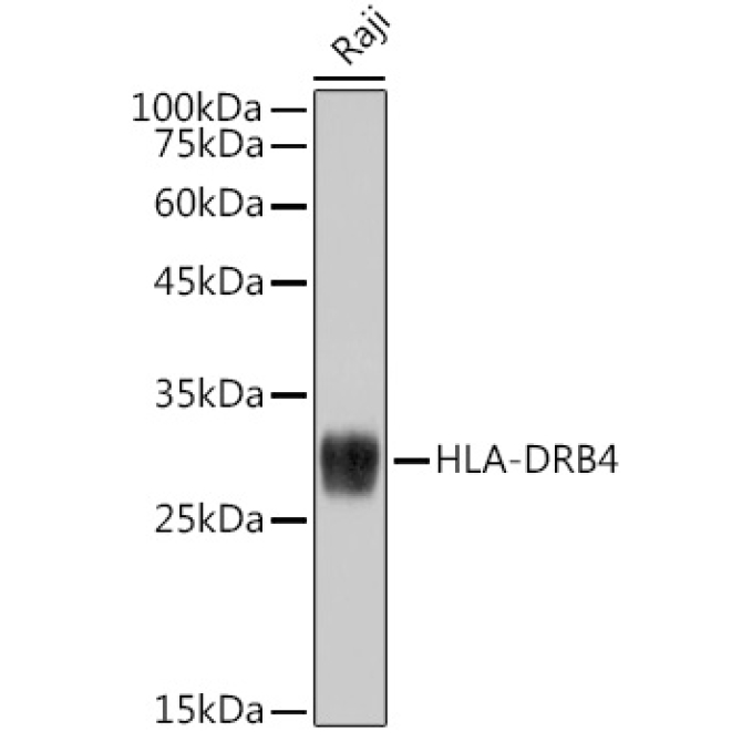 HLA-DRB4 Rabbit Monoclonal Antibody