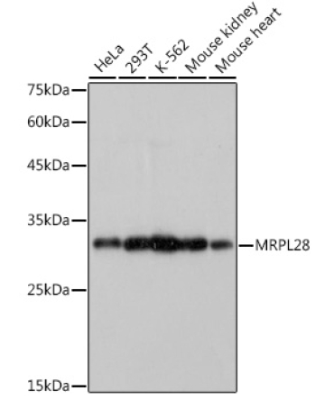 MRPL28 Rabbit Monoclonal Antibody