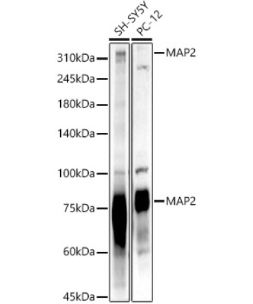 MAP2 Rabbit Polyclonal Antibody