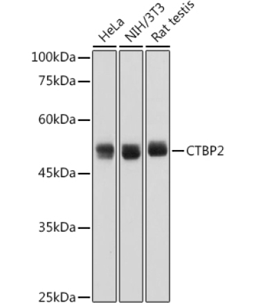 CTBP2 Rabbit Monoclonal Antibody
