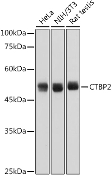 CTBP2 Rabbit Monoclonal Antibody