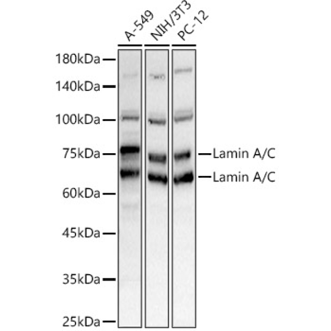 Lamin A/C Rabbit Polyclonal Antibody
