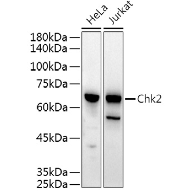 Chk2 Rabbit Polyclonal Antibody