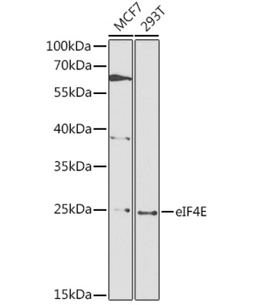 eIF4E Rabbit Polyclonal Antibody
