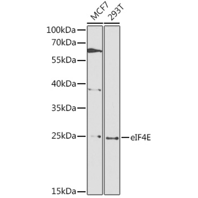 eIF4E Rabbit Polyclonal Antibody