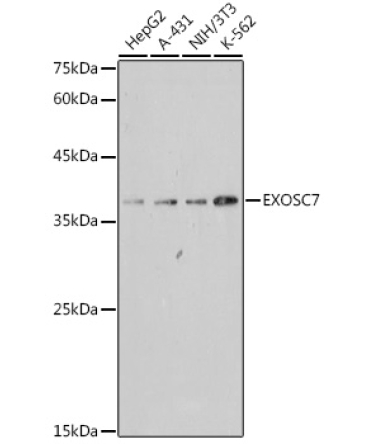EXOSC7 Rabbit Monoclonal Antibody