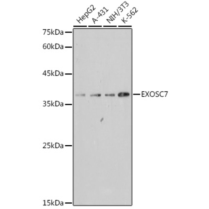 EXOSC7 Rabbit Monoclonal Antibody