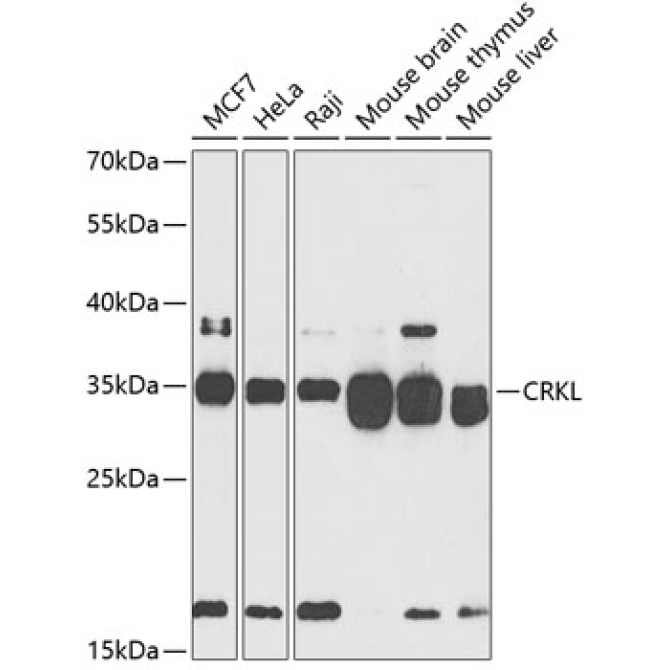 CRKL Rabbit Polyclonal Antibody