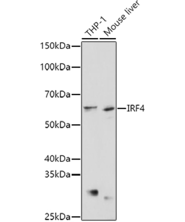 IRF4 Rabbit Polyclonal Antibody