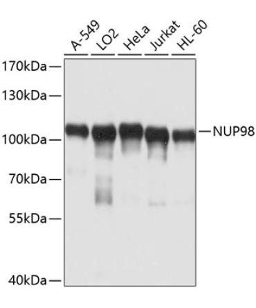 NUP98 Rabbit Polyclonal Antibody