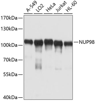 NUP98 Rabbit Polyclonal Antibody