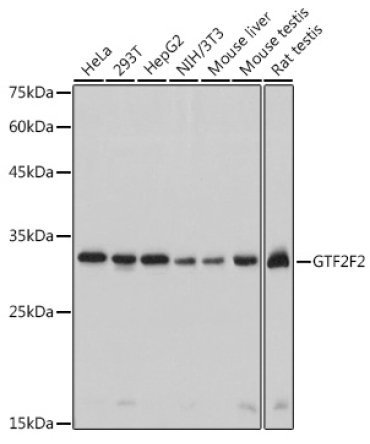 GTF2F2 Rabbit Monoclonal Antibody