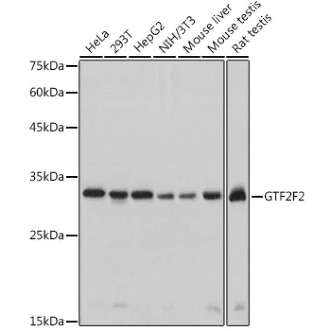 GTF2F2 Rabbit Monoclonal Antibody
