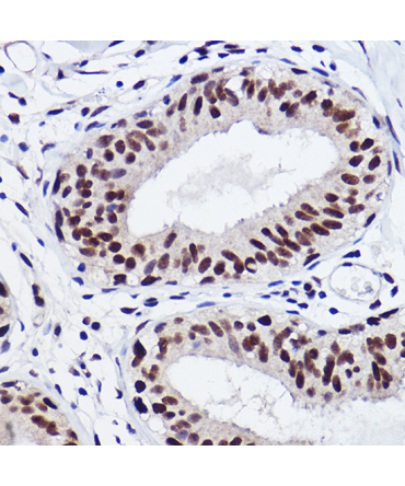 GTF2I Rabbit Monoclonal Antibody