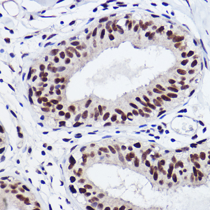 GTF2I Rabbit Monoclonal Antibody