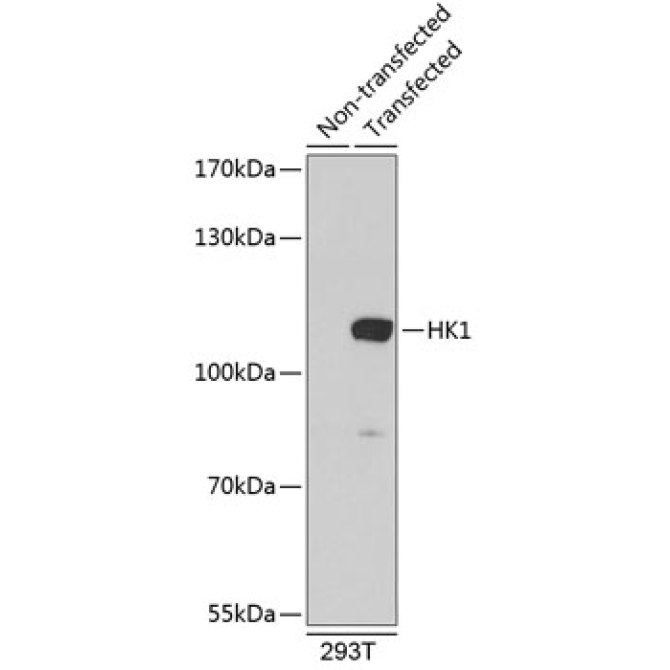 HK1 Rabbit Polyclonal Antibody
