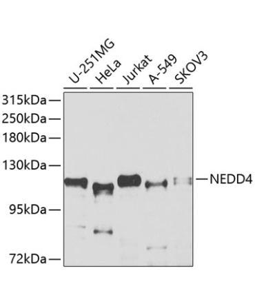 NEDD4 Rabbit Polyclonal Antibody
