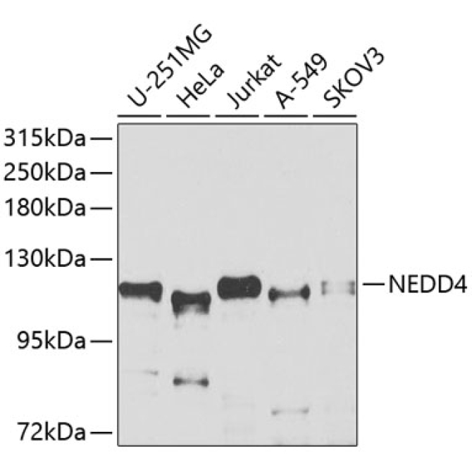NEDD4 Rabbit Polyclonal Antibody