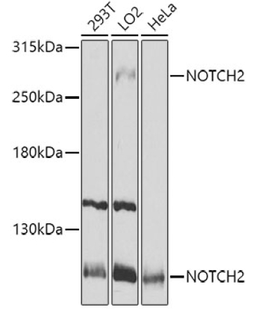NOTCH2 Rabbit Polyclonal Antibody