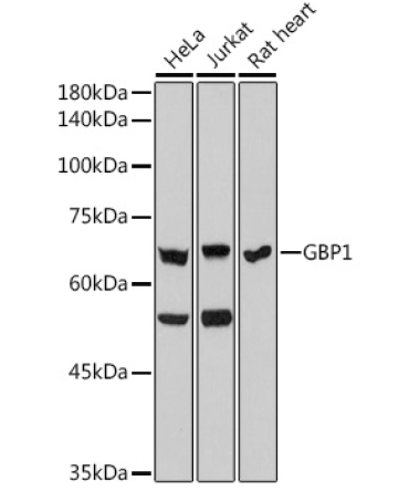 GBP1 Rabbit Monoclonal Antibody