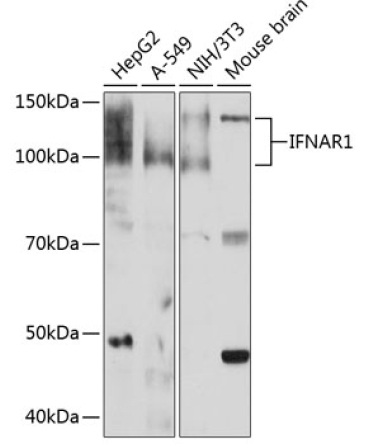 IFNAR1 Rabbit Monoclonal Antibody