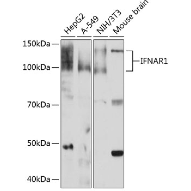 IFNAR1 Rabbit Monoclonal Antibody