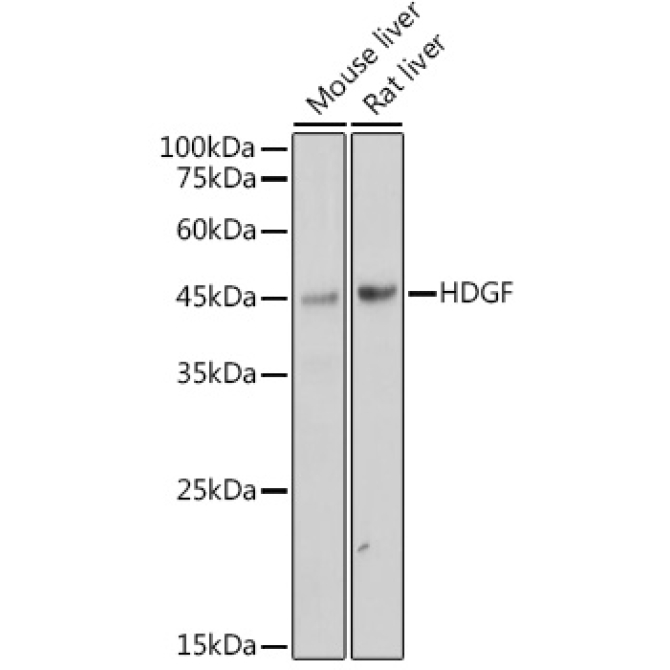 HDGF Rabbit Monoclonal Antibody