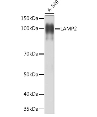 LAMP2 Rabbit Monoclonal Antibody