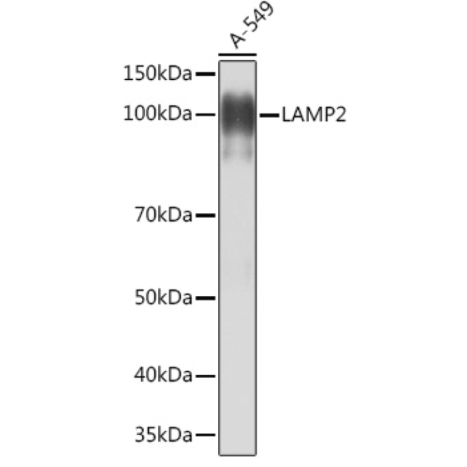 LAMP2 Rabbit Monoclonal Antibody