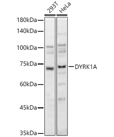 DYRK1A Rabbit Polyclonal Antibody