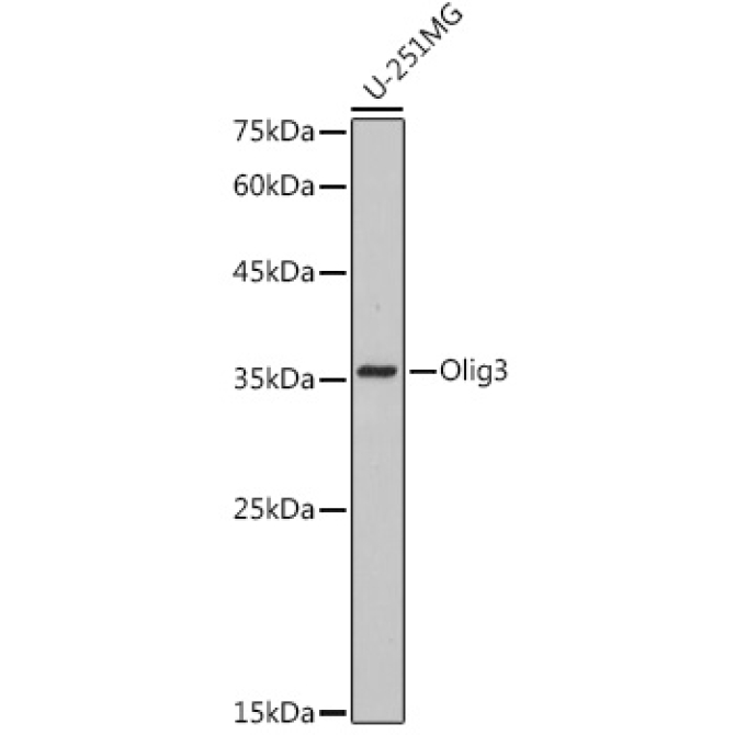 Olig3 Rabbit Monoclonal Antibody