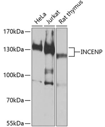 INCENP Rabbit Polyclonal Antibody