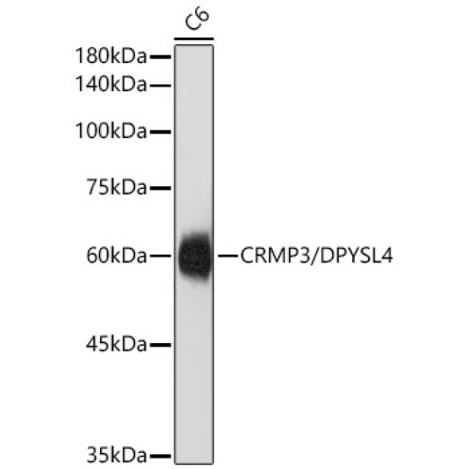 CRMP3/DPYSL4 Rabbit Monoclonal Antibody