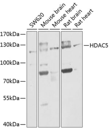 HDAC5 Rabbit Polyclonal Antibody