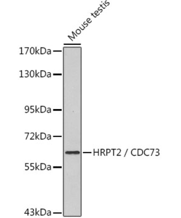 HRPT2 / CDC73 Rabbit Polyclonal Antibody