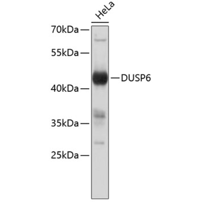 DUSP6 Rabbit Polyclonal Antibody