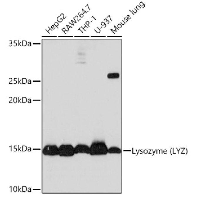 Lysozyme (LYZ) Rabbit Monoclonal Antibody