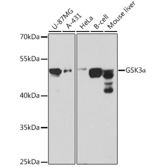 GSK3Alpha Rabbit Polyclonal Antibody