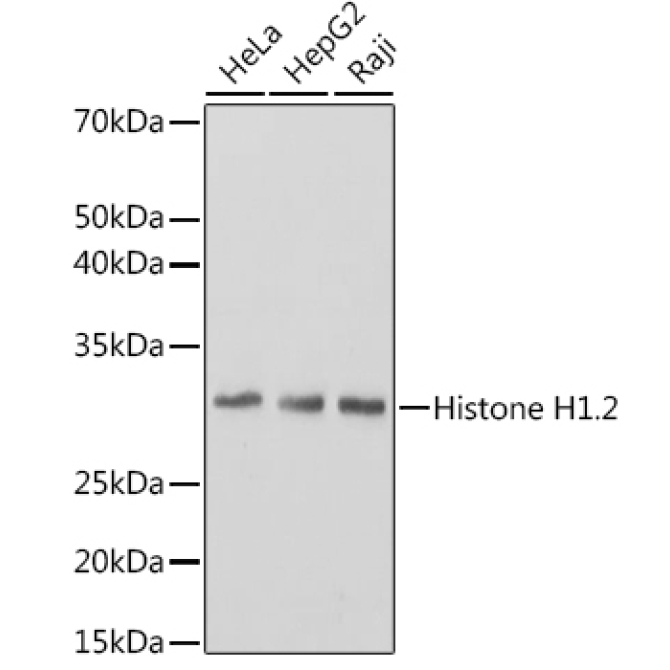 Histone H1.2 Rabbit Monoclonal Antibody