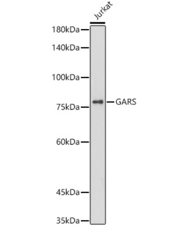 GARS Rabbit Monoclonal Antibody [KO Validated]