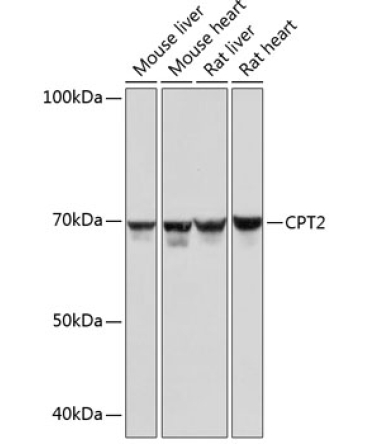CPT2 Rabbit Monoclonal Antibody