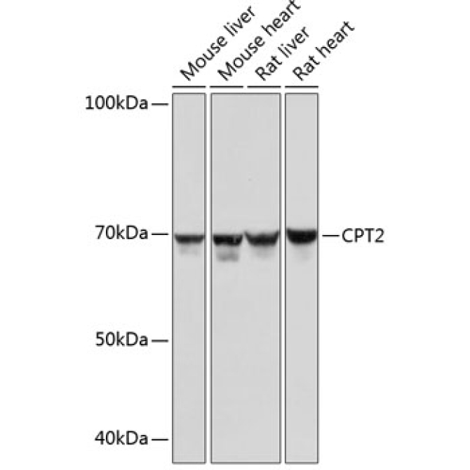 CPT2 Rabbit Monoclonal Antibody