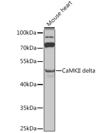 CaMKII delta Rabbit Polyclonal Antibody