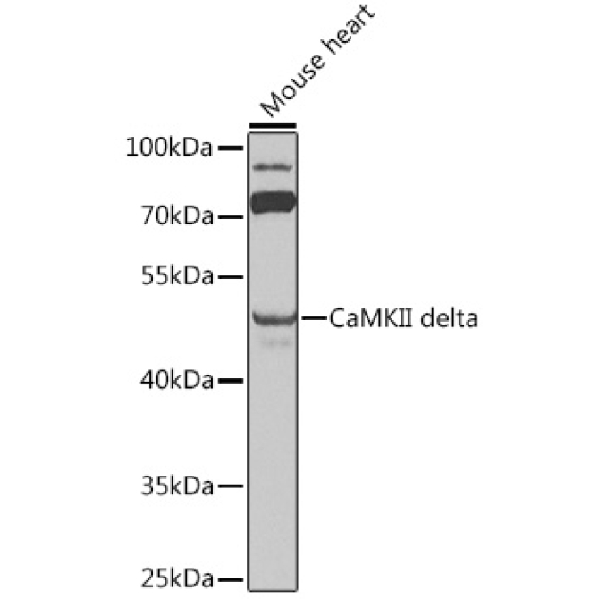 CaMKII delta Rabbit Polyclonal Antibody