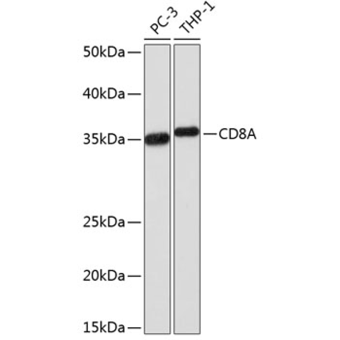 CD8A Rabbit Monoclonal Antibody