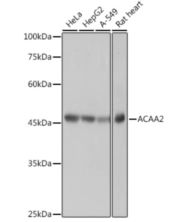 ACAA2 Rabbit Monoclonal Antibody